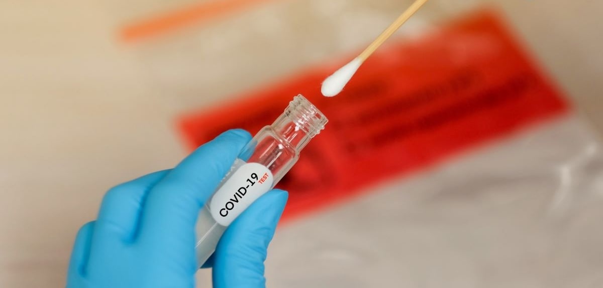 Ситуация с заболеваемостью COVID-19 в странах Центральной Азии