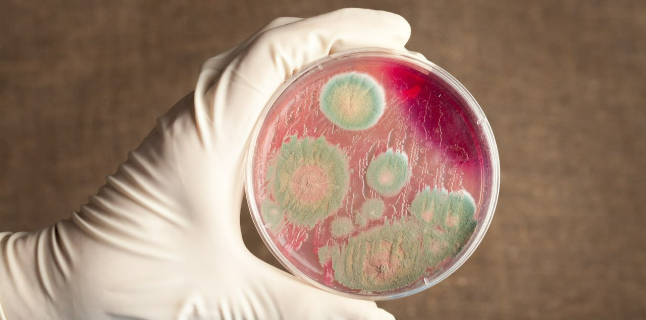 В Костанайской области Казахстана произошла вспышка сибирской язвы